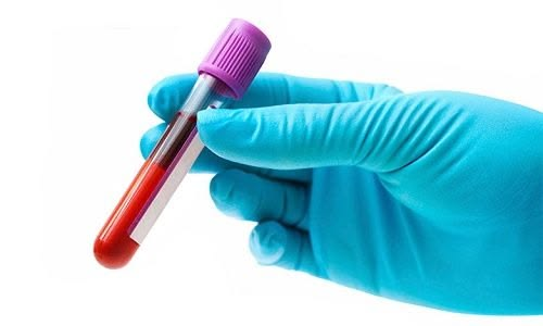 Is P-Shot Right for You? Getting to Know Its Pros and Cons